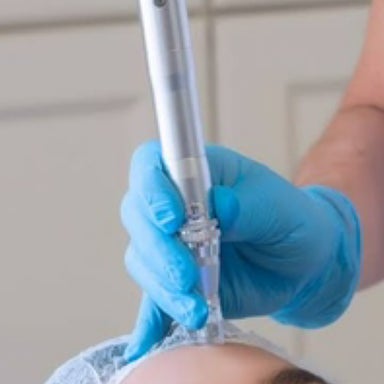 Micro-Needling Face