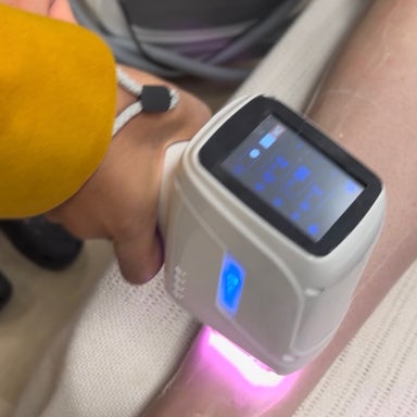 Underarms Laser hair removal