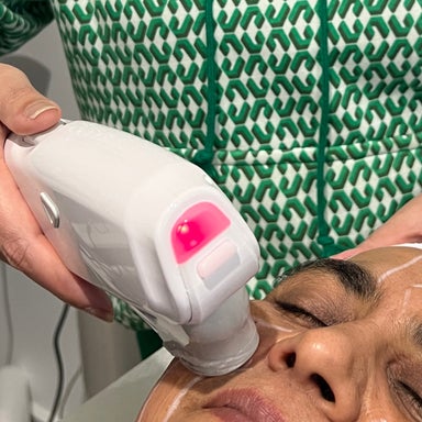 HIFU Face & Neck Lift
