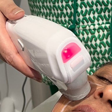 Hifu Face side lifting